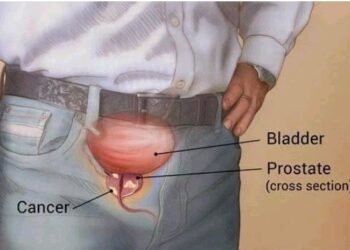 Five Early Warning Signs Of An Enlarged Prostate That Every Man Need To Know